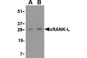 Western Blotting (WB) image for anti-Tumor Necrosis Factor (Ligand) Superfamily, Member 11 (TNFSF11) (Middle Region) antibody (ABIN1031107) (RANKL 抗体  (Middle Region))