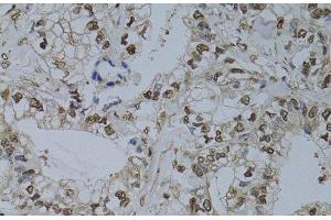 Immunohistochemistry (Paraffin-embedded Sections) (IHC (p)) image for anti-HUS1 Checkpoint Homolog (S. Pombe) (HUS1) antibody (ABIN7257499)