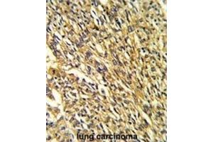 Immunohistochemistry (IHC) image for anti-Potassium Inwardly-Rectifying Channel, Subfamily J, Member 2 (KCNJ2) antibody (ABIN3002884) (KCNJ2 抗体)