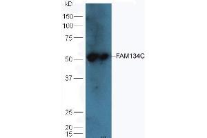 Mouse liver lysates probed with Rabbit Anti-FAM134C Polyclonal Antibody (ABIN872917) at 1:300 overnight in 4 °C. (FAM134C 抗体  (AA 76-180))