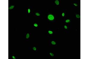 Immunofluorescence staining of U251 cells with ABIN7146450 at 1:133, counter-stained with DAPI. (CACYBP 抗体  (AA 2-228))