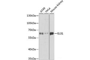 Western blot analysis of extracts of various cell lines using GLB1 Polyclonal Antibody at dilution of 1:1000. (GLB1 抗体)