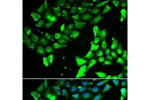 Immunofluorescence analysis of A549 cells using KIF2B Polyclonal Antibody (KIF2B 抗体)