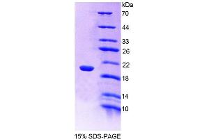 SDS-PAGE analysis of Mouse CREG1 Protein. (CREG1 蛋白)