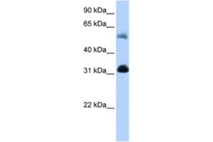 Western Blotting (WB) image for anti-3-Oxoacid CoA Transferase 1 (OXCT1) antibody (ABIN2463187) (OXCT1 抗体)