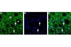 Expression of Choline transporter in rat striatum - Immunohistochemical staining of rat frozen brain sections using Anti-Choline Transporter (SLC5A7) (extracellular) Antibody (ABIN7043267 and ABIN7044218) (1:200). (ChT 抗体  (Extracellular))