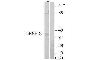 Western blot analysis of extracts from HeLa cells, using hnRNP G antibody. (RBMX 抗体  (N-Term))