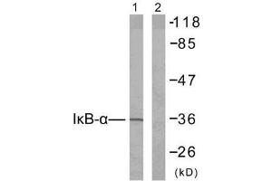 Western blot analysis of extracts from 293 cells untreated or treated with TNF-α (20ng/ml, 30min), using IκB-α (Ab-42) antibody (E021176). (NFKBIA 抗体)