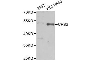 Western blot analysis of extracts of various cell lines, using CPB2 Antibody (ABIN1876835) at 1:1000 dilution. (CPB2 抗体)