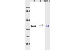 Lane 1: rat brain lysates Lane 2: rat kidney lysates probed with Anti Inhibin Alpha Polyclonal Antibody, Unconjugated (ABIN736656) at 1:200 in 4 °C. (Inhibin alpha 抗体  (AA 301-366))