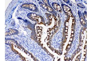 IHC analysis of Cytokeratin 8 using anti- Cytokeratin 8 antibody . (KRT8 抗体  (AA 107-325))