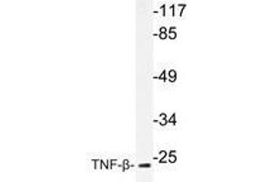 Western blot analysis of TNF-β antibody in extracts from COS-7cells. (LTA 抗体)