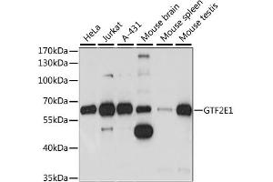 Western blot analysis of extracts of various cell lines, using GTF2E1 antibody (ABIN6292967) at 1:1000 dilution. (GTF2E1 抗体)