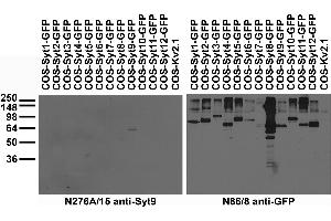 Immunohistochemistry with antigen retrieval via citrate pretreatment. (LGI1 抗体  (AA 37-113))