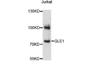 Western blot analysis of extracts of Jurkat cells, using GLE1 antibody (ABIN6293109) at 1:3000 dilution. (GLE1 抗体)