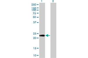 Western Blot analysis of PTTG1IP expression in transfected 293T cell line by PTTG1IP monoclonal antibody (M04), clone 4C11. (PTTG1IP 抗体  (AA 1-180))