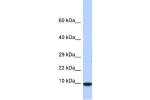 WB Suggested Anti-PCBD1 Antibody Titration:  0. (PCBD1 抗体  (N-Term))