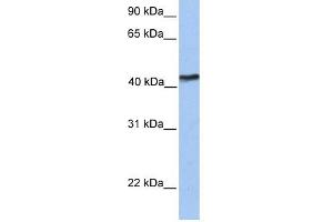 TMEM149 antibody used at 1 ug/ml to detect target protein. (IGF-like family receptor 1 (IGFLR1) (N-Term) 抗体)