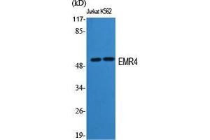 Western Blot (WB) analysis of specific cells using EMR4 Polyclonal Antibody. (EMR4 抗体  (Internal Region))