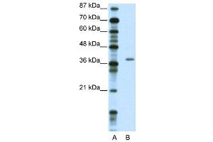 WB Suggested Anti-ZNF444  Antibody Titration: 2. (ZNF444 抗体  (C-Term))