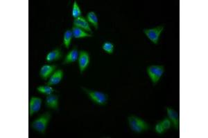 Immunofluorescence staining of Hela cells with ABIN7153359 at 1:166, counter-stained with DAPI. (Gpr98 抗体  (AA 6155-6306))