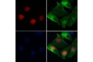 HELLS Antibody staining Hela cells by IF/ICC.