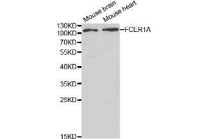 Western blot analysis of extracts of various cell lines, using FCER1A antibody. (Fc epsilon RI/FCER1A 抗体  (AA 26-205))
