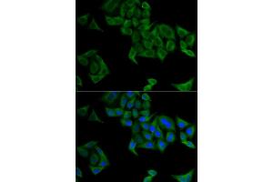 Immunofluorescence analysis of  cells using SMYD5 antibody (ABIN6129324, ABIN6148173, ABIN6148174 and ABIN6221783). (SMYD5 抗体)