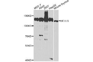 Western blot analysis of extracts of various cell lines, using HELLS antibody (ABIN2563021) at 1:1000 dilution. (HELLS 抗体)