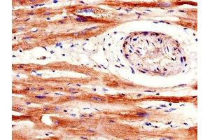 IHC image of ABIN7168677 diluted at 1:600 and staining in paraffin-embedded human heart tissue performed on a Leica BondTM system. (SFRP1 抗体  (AA 170-240))