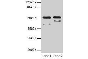 Western blot All lanes: CRHR1 antibody at 16 μg/mL Lane 1: Hela whole cell lysate Lane 2: HL60 whole cell lysate Secondary Goat polyclonal to rabbit IgG at 1/10000 dilution Predicted band size: 51, 48, 44, 47, 29 kDa Observed band size: 51 kDa (CRHR1 抗体  (AA 24-121))