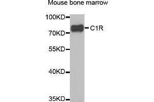 Western blot analysis of extracts of mouse bone marrow, using C1R antibody (ABIN5973769) at 1/1000 dilution. (C1R 抗体)