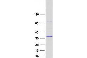 Western Blotting (WB) image for Gem (Nuclear Organelle) Associated Protein 8 (GEMIN8) (Transcript Variant 1) protein (Myc-DYKDDDDK Tag) (ABIN2721805)