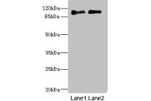 Western blot All lanes: ICAM5 antibody at 4. (ICAM5 抗体  (AA 32-180))