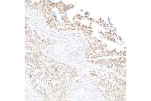 anti-Lysine (K)-Specific Demethylase 2A (KDM2A) (AA 825-875) antibody