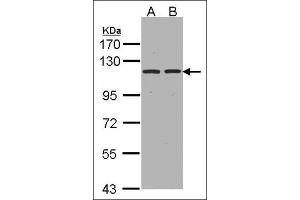 Sample(30 µg whole cell lysate). (ENPEP 抗体  (Tyr182))
