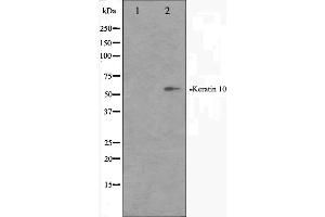 Western blot analysis on HeLa cell lysate using Keratin 10 Antibody.