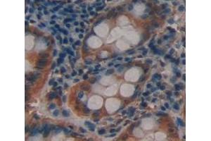 Used in DAB staining on fromalin fixed paraffin- embedded Kidney tissue (ACTN3 抗体  (AA 162-416))