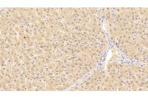 Detection of ALT in Human Liver Tissue using Monoclonal Antibody to Alanine Aminotransferase (ALT) (ALT 抗体  (AA 255-492))