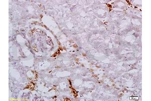 Formalin-fixed and paraffin embedded mouse kidney labeled with Anti AAK1 Polyclonal Antibody, Unconjugated (ABIN687517) at 1:200 followed by conjugation to the secondary antibody and DAB staining (AAK1 抗体  (AA 301-400))