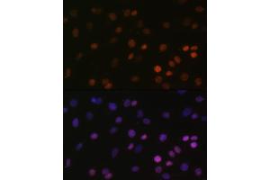 Immunofluorescence analysis of C6 cells using MonoMethyl-Histone H2B-K5 antibody (ABIN7267735) at dilution of 1:100. (Histone H2B 抗体  (meLys5))