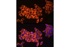 Immunofluorescence analysis of HeLa cells using UB Rabbit mAb (ABIN7271128) at dilution of 1:50 (40x lens).