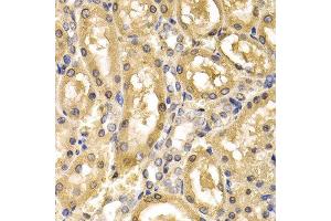 Immunohistochemistry of paraffin-embedded rat kidney using ADH4 antibody at dilution of 1:200 (400x lens). (ADH4 抗体)