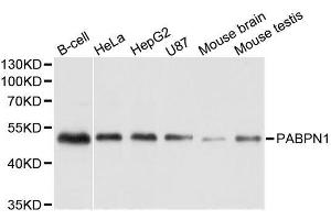 Western blot analysis of extracts of various cell lines, using PABPN1 antibody. (PABPN1 抗体  (AA 1-100))