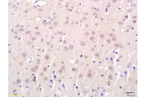 Formalin-fixed and paraffin embedded rat brain labeled with Anti-Connexin-32 Polyclonal Antibody, Unconjugated (ABIN685672) followed by conjugation to the secondary antibody and DAB staining