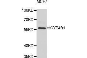Western blot analysis of extracts of MCF-7 cells, using CYP4B1 antibody (ABIN5975064) at 1/1000 dilution. (CYP4B1 抗体)