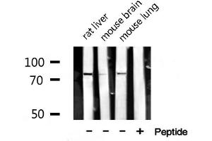 Western blot analysis of extracts of various tissue ,using SENP1 antibody. (SENP1 抗体  (N-Term))