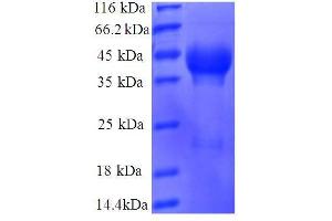 Ribosomal Protein L35 (RPL35) (AA 2-123), (full length) protein (GST tag) (RPL35 Protein (AA 2-123, full length) (GST tag))