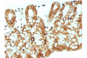 Formalin-fixed, paraffin-embedded Mouse Colon stained with EpCAM Mouse Monoclonal Antibody (EGP40/1110).