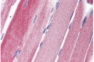 Human Skeletal Muscle (formalin-fixed, paraffin-embedded) stained with GPAM antibody ABIN351457 at 5 ug/ml followed by biotinylated goat anti-rabbit IgG secondary antibody ABIN481713, alkaline phosphatase-streptavidin and chromogen. (GPAM 抗体  (C-Term))
